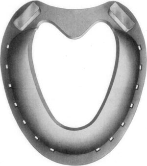 Fig. 35&mdash;Inferior (convex) surface of Cochran shoe.