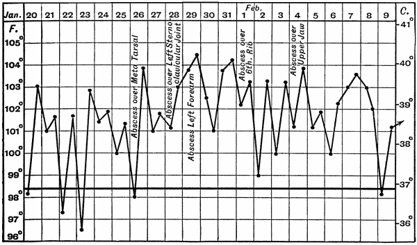 Fig. 13.&mdash;Chart of Py&aelig;mia following on Acute Osteomyelitis.
