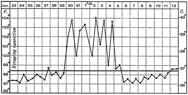 Fig. 25.&mdash;Chart of Erysipelas occurring in a wound.