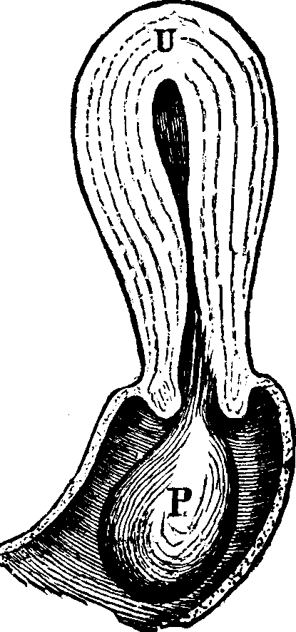Illustration:
Fig. 21. U, Uterus. P, Polypus.