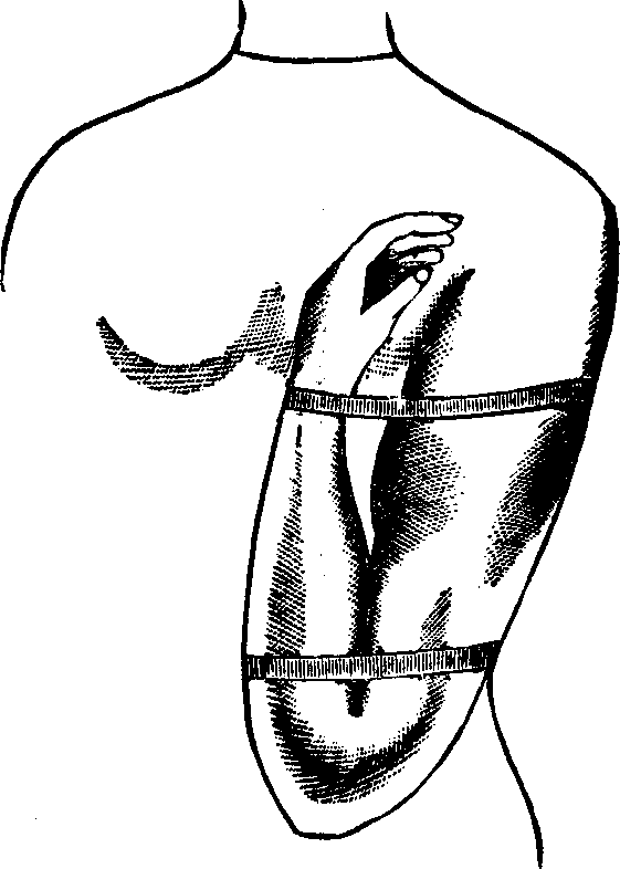 Illustration:
Fig. 2. Mode of employing flexion for the arrest of hemorrhage from a wound
located below the elbow. 