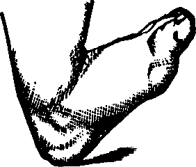 Illustration:
Fig. 17.