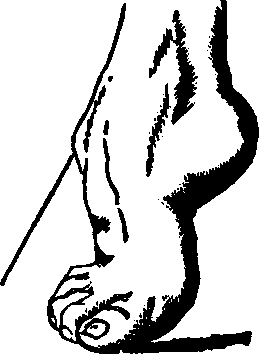 Illustration:
Fig. 19.