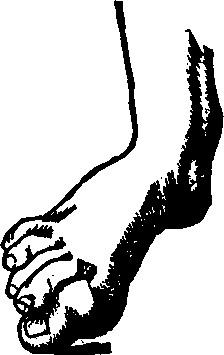 Illustration:
Fig. 22. The above illustrations represent various Deformities cured by our
Specialists at the Invalids' Hotel and Surgical Institute.