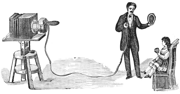 TN: Using the Pneumatic Shutter to Photograph
a Child.