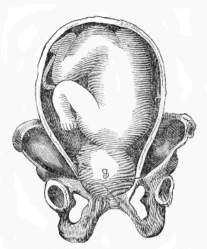 head
entering upper Strait