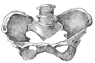 Ovate
Pelvis